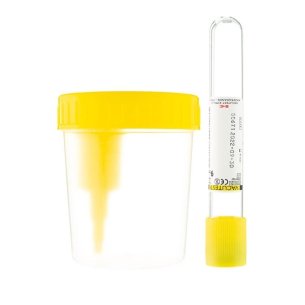 Envase recogida orina con tubo de vacío 100 ml