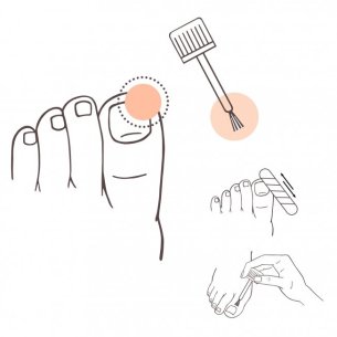 PRANAROM AROMADERM FONGIAROM SOLUCIÓN UÑAS 10 ml 2